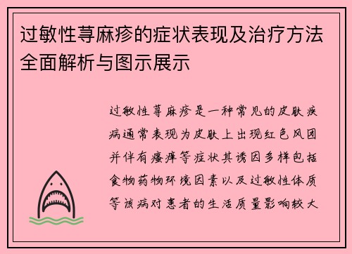 过敏性荨麻疹的症状表现及治疗方法全面解析与图示展示